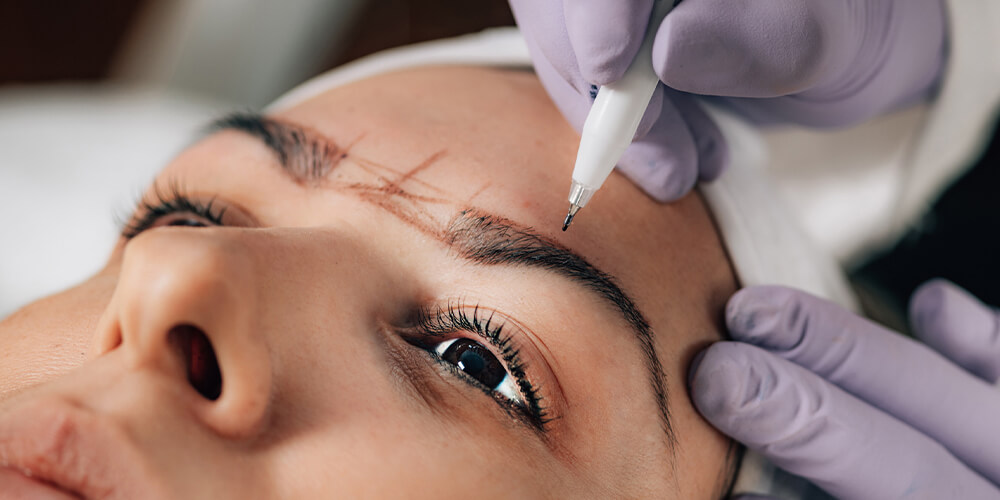 Barthaartransplantationen für einen volleren Bartwuchs – Dion Hair Clinic informiert