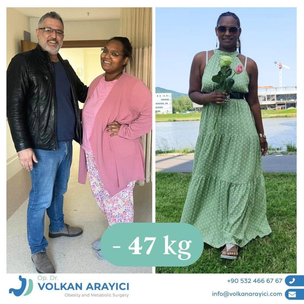 Gastric Sleeve Türkei: Preisfrage einfach erklärt